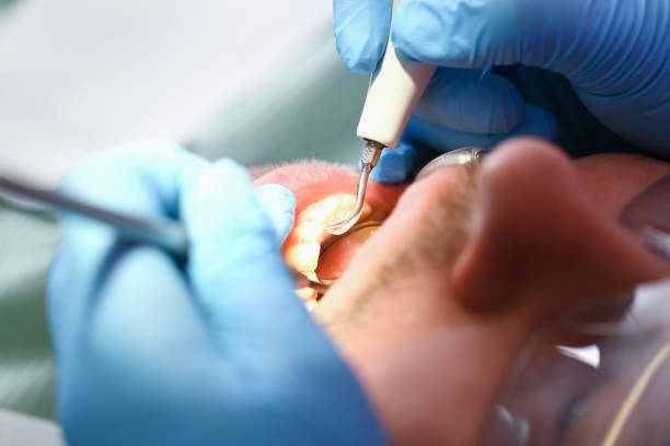 Best Emergency Gum Treatment in Holly, MI